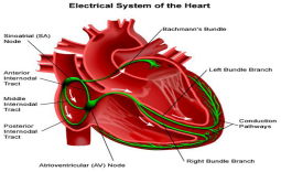 XỬ TRÍ CẤP CỨU NHỊP NHANH QRS HẸP