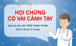 HỘI CHỨNG CỔ VAI CÁNH TAY