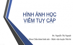 HÌNH ẢNH HỌC VIÊM TUỴ CẤP